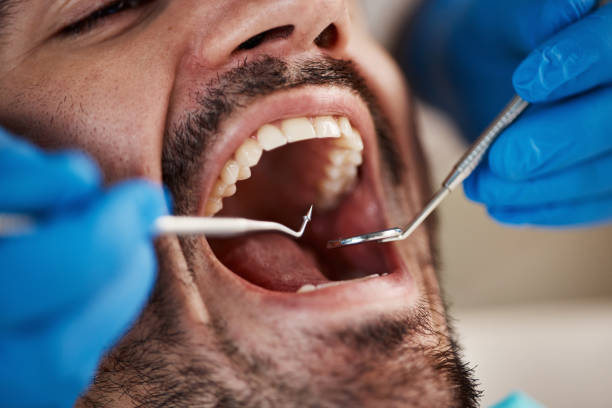 Best Emergency Broken Tooth Repair in Sound Beach, NY